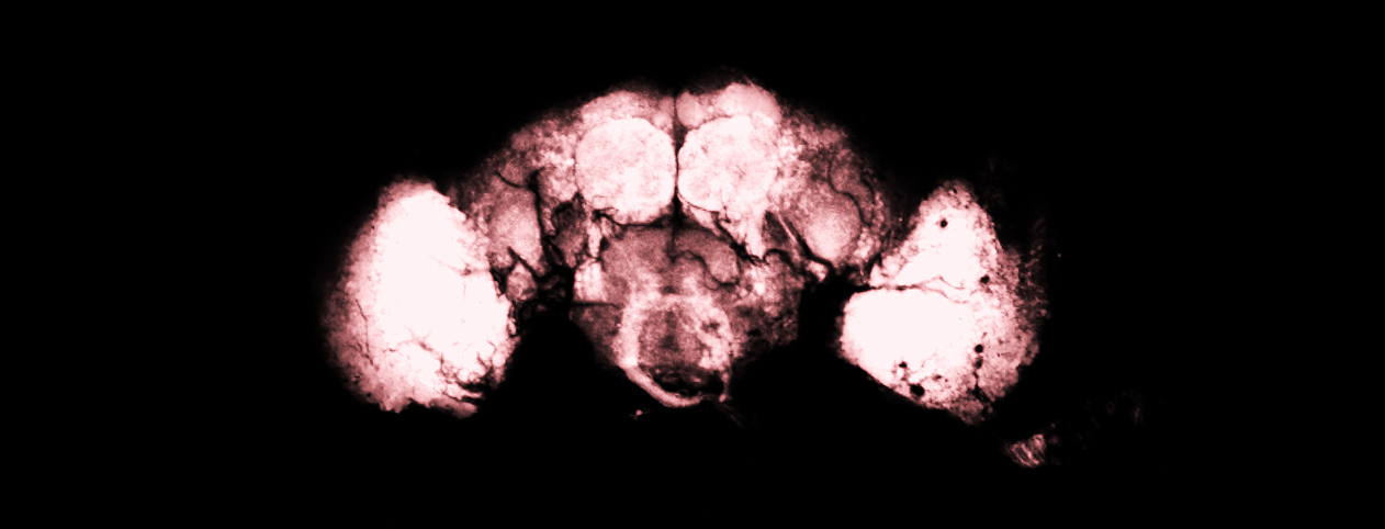 Optic lobe neurons highlighted in pink