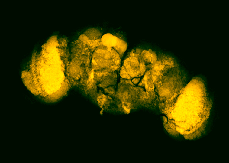 Neuronal projections revealed by sparse labelling