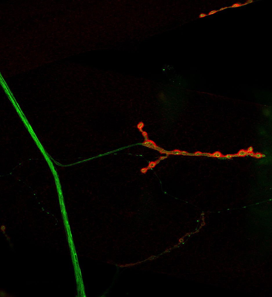 NMJ stained with pre- and post-synaptic markers
